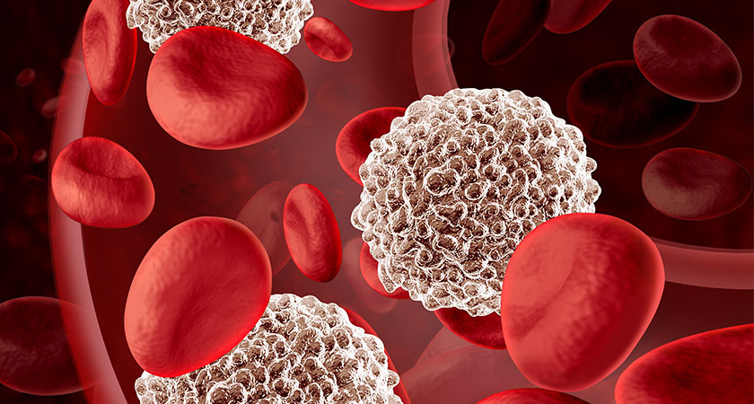  Hematología en 5 partes