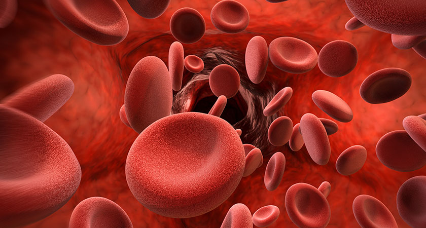  Hematología en 3 partes