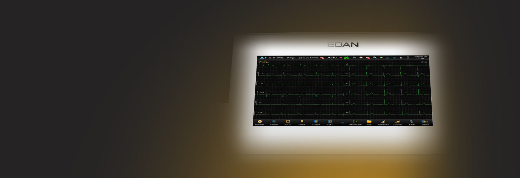 Barra de herramientas configurable