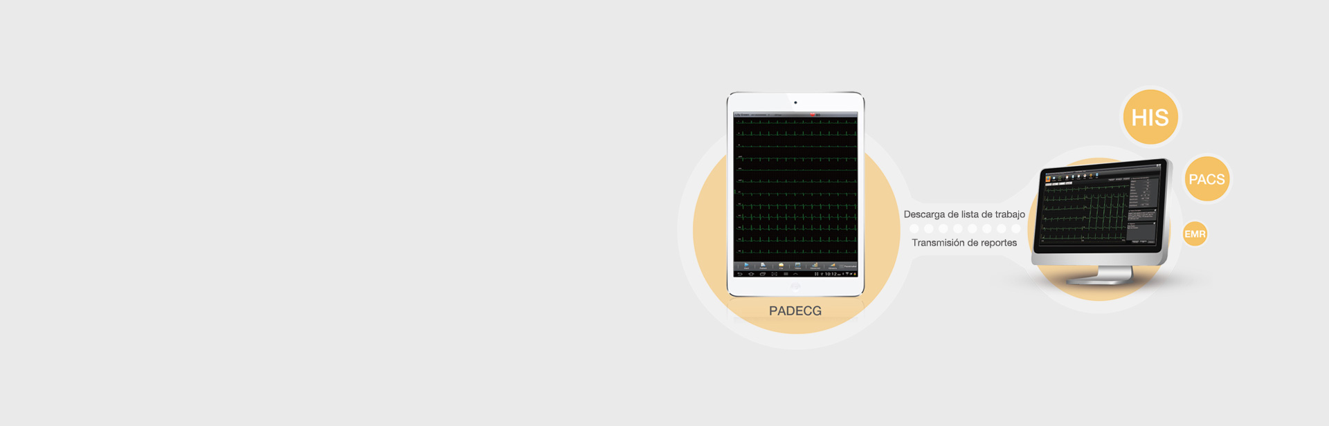 Flujo de trabajo digitalizado y gestión de ECG remota