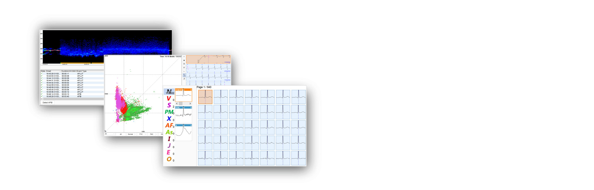 Herramientas de análisis de ECG