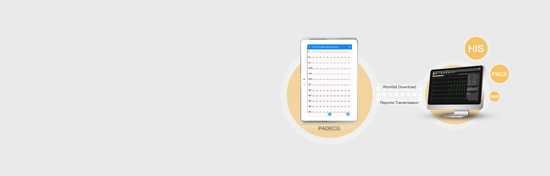 Flujo de trabajo digitalizado y gestión de ECG remota