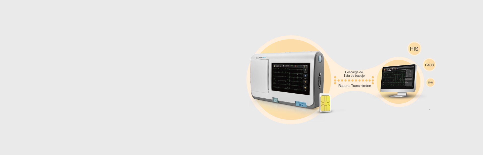 Conectar sus datos de ECG por red